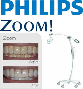 Philips Zoom professzionális fogfehérítő gép - Implant Corner
