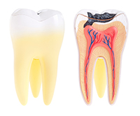 A fogszuvasodás megelőzése fogorvos